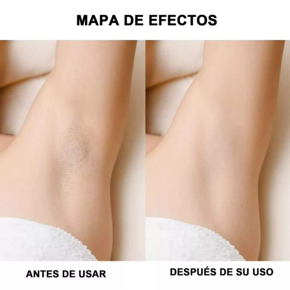 ÚLTIMO DÍA CON UN 40% 0FF - Depiladora Yes 2 en 1 - DEPILACIÓN LASER RÁPIDA Y INDOLORA