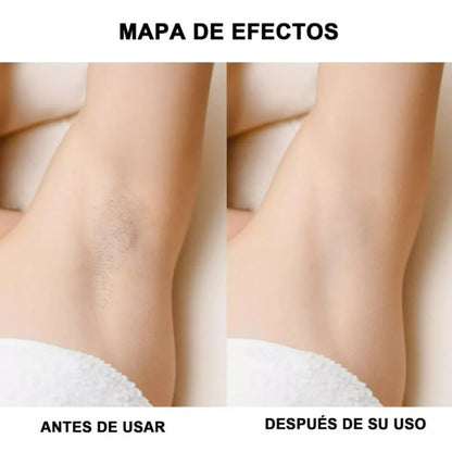 ÚLTIMO DÍA CON UN 40% 0FF - Depiladora Yes 2 en 1 - DEPILACIÓN LASER RÁPIDA Y INDOLORA
